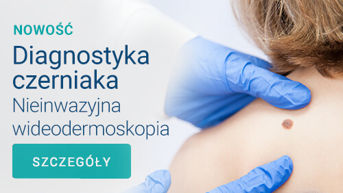 Diagnostyka czerniaka - Sonomed Szczecin