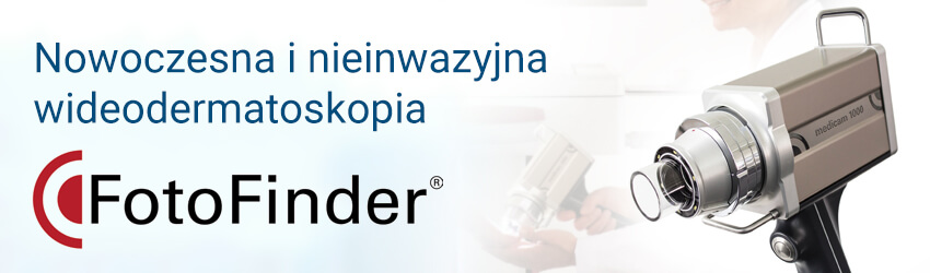 Foto Finder - diagnostyka czerniaka Szczecin