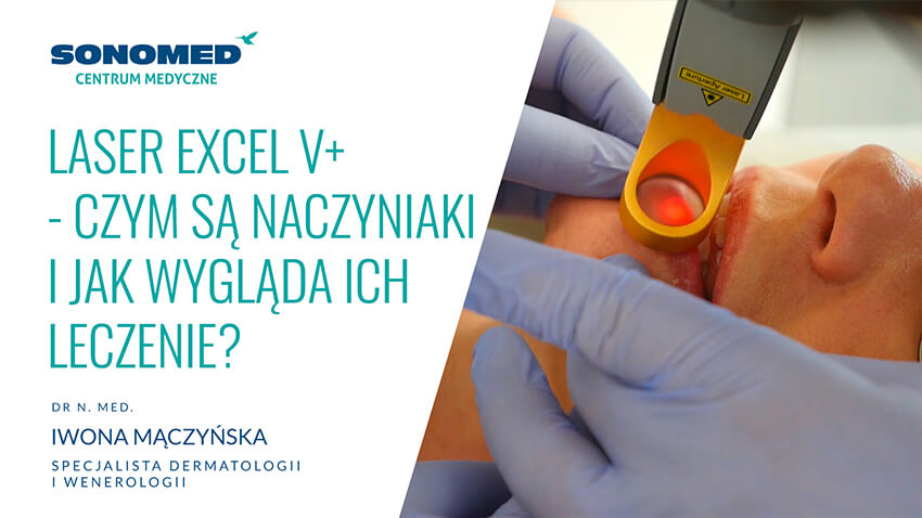 Czym są naczyniaki i jak wygląda ich leczenie? Laser Cutera Excel V+